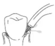 Waterpik WF03 - Pik Pocket™ Tip - 1