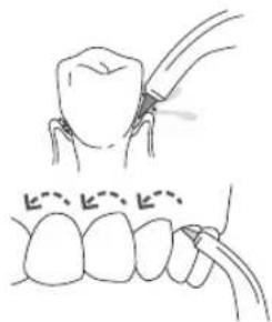 Waterpik WF03 - Per usare il beccuccio Pik Pocket, impostare I'unita sul valore di pressione più basso. - 1