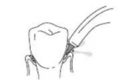 Waterpik WF03 - Pik Pocket Tip - 1
