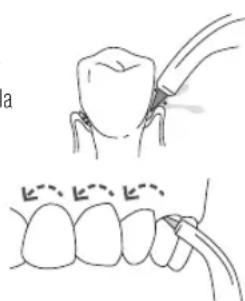 Waterpik WF03 - Pik Pocket, selectionnez la plus bajo - 1