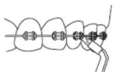 Waterpik WF03 - Toothbrush Tip - 2