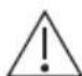 ELECTROLUX ESF5512LOW - ATTENTION! - 1