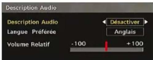 SABA SCB1910VX - Description Audio (En option) - 1