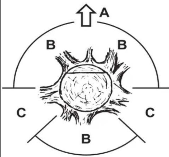 Anova ME2C - BG - 11