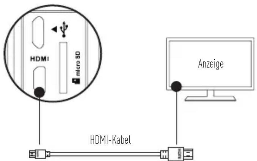 EZVIZ S5 Plus - Anschluss an einen Monitor - 1