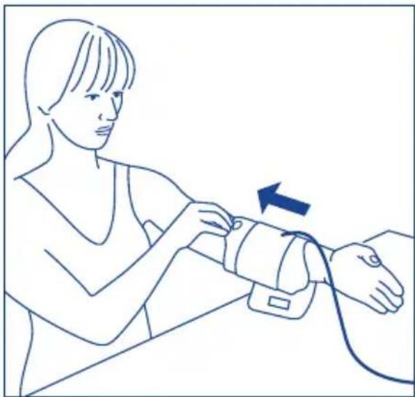 Tensoval Duo Control - Aanleggen van de manchet - 1