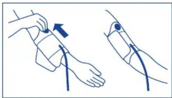 Tensoval Duo Control - Applicazione del bracciale - 3