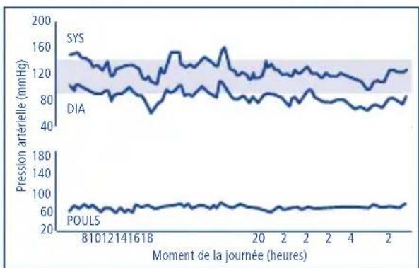 Tensoval Duo Control - Mesures régulières de la pression arterielle - 1