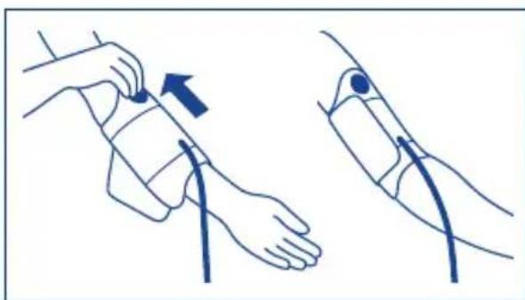 Tensoval Duo Control - Applying the cuff - 3
