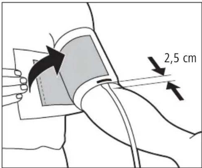 Tensoval Comfort - Aanleggen van de manchet - 1