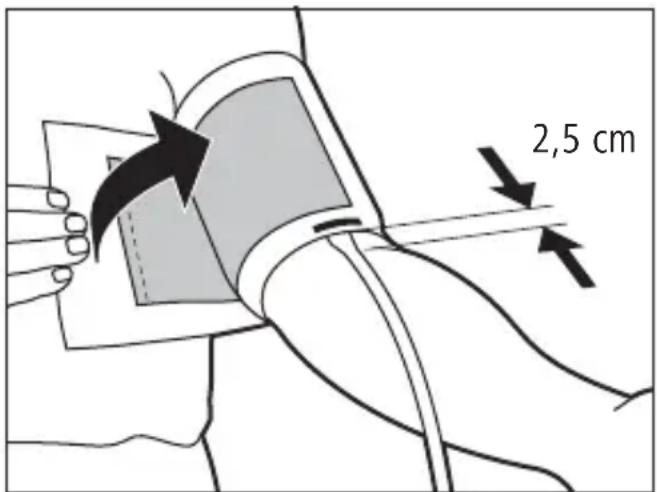 Tensoval Comfort - Applicazione del bracciale - 1