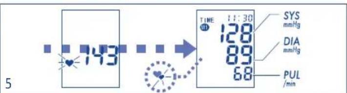 Tensoval Mobil Classic - Mesure de la tension arterielle - 1
