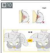 MEDELA Freestyle - 10
