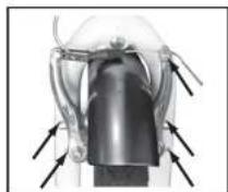 WAYSCRAL City 520 - Freni V-brake - 2