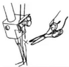 QUIGG MD 10685 - Changement de fil - 2