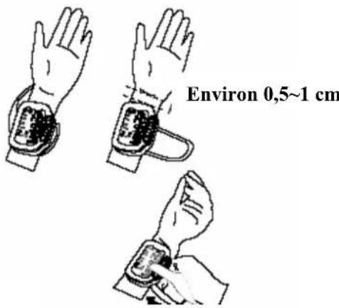 INOVALLEY 0095 - G- Fixation du bracelet - 1
