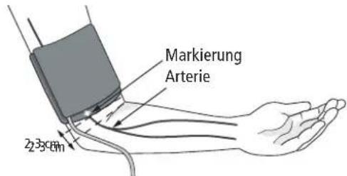 BOSO Egotest - Anlagen der Manschette - 1