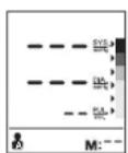 BRAUN ExactFit 3 - ydaeneHne daHHbIX - 2