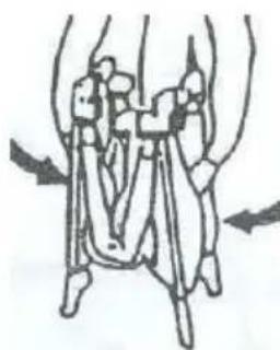 Topmark Charlie - PARAPLEGAR - 5