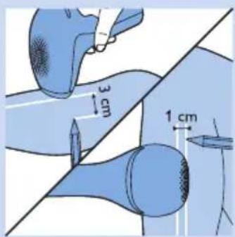 PHILIPS Lumea Precision SC2008 - Using the appliance on the legs - 3