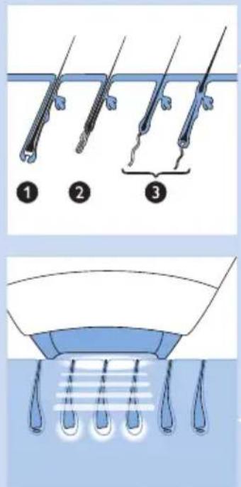 PHILIPS Lumea Precision SC2008 - How Philips' Intense Pulsed Light technology works - 1