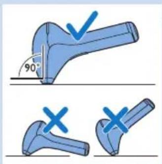 PHILIPS Lumea Precision SC2008 - Subsequent use - 4