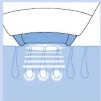 PHILIPS Lumea Precision SC2008 - Working principle - 2