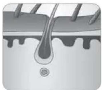 BABYLISS Homelight G940E - Wie konnen Haare durch Licht beseitigt werden? - 5