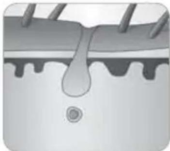 BABYLISS Homelight G940E - How does the light eliminate hair? - 7