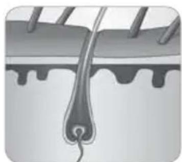 BABYLISS Homelight G940E - Wie konnen Haare durch Licht beseitigt werden? - 4