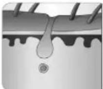 BEURER SalonPro System IPL 9000 - How does the light remove the hair? - 3