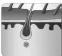 BEURER SalonPro System IPL 9000 - Welchen Einfluss hat der Haarwuchszyklus auf die auf Licht basierende Haarentfernung? - 1