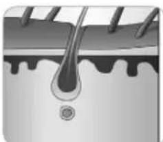 BEURER SalonPro System IPL 9000 - Che cos'è SalonPro System di beurer? - 5