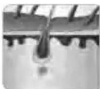 BEURER SatinSkin Pro IPL 7000 - M9d9JdFJC6E5A9EH. AFED9JdFJ,HJDF5E9,91HJ(: L - 2