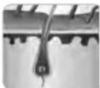 BEURER SatinSkin Pro IPL 7000 - M9d9JdFJC6E5A9EH. AFED9JdFJ,HJDF5E9,91HJ(: L - 1