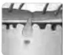 BEURER SatinSkin Pro IPL 7000 - M9d9JdFJC6E5A9EH. AFED9JdFJ,HJDF5E9,91HJ(: L - 4