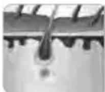 BEURER SatinSkin Pro IPL 7000 - Co7.9102 1sc.91%9c1c09d19c-. sc1,a9d. 19p. 919s . p1%azlo0.96asa,a9s a9c.? - 2