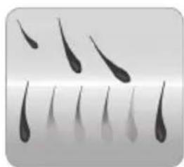 BABYLISS Homelight G932E - How does the light eliminate hair? - 4