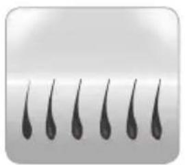 BABYLISS Homelight G932E - Wie können Haare durch Licht beseitigt werden? - 1