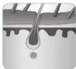 BABYLISS Homelight G932E - How does the light eliminate hair? - 6