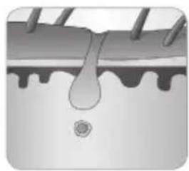 BABYLISS Homelight G932E - Wie können Haare durch Licht beseitigt werden? - 6