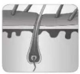 BABYLISS Homelight G932E - Hoe kanlichteenhaartjeverwijlderen? - 4