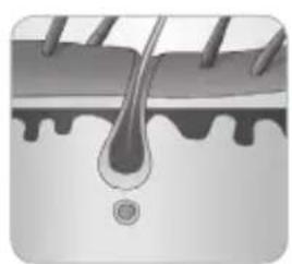 BABYLISS Homelight G932E - In che modo la luce riesce a eliminare il pelo? - 5