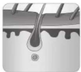 BABYLISS Homelight G932E - Cómo logra la luz eliminar el vello? - 5