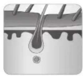 BABYLISS Homelight G932E - Hoe kanlichteenhaartjeverwijlderen? - 5