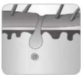 BABYLISS Homelight G932E - In che modo la luce riesce a eliminare il pelo? - 6
