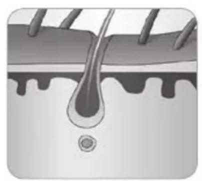 BABYLISS Homelight G930E - Hoe kanlichteenhaartje verwijderen? - 5