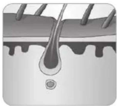 BABYLISS Homelight G930E - How does the light eliminate hair? - 5
