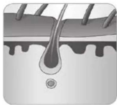 BABYLISS Homelight G930E - ¿Cómo logra la luz eliminar el vello? - 5