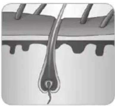 BABYLISS Homelight G930E - How does the light eliminate hair? - 4